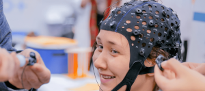 discalculia y estimulación transcraneal directa