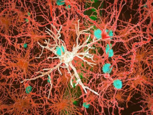 Microglia y Alzheimer